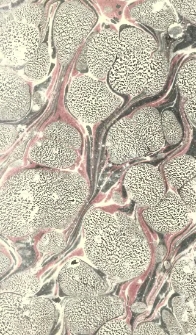 Handbuch der Akiurgie : zum Gebrauche bei Vorlesungen und zum Selbstunterricht. T.2
