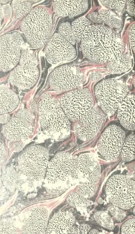 Handbuch der Akiurgie : zum Gebrauche bei Vorlesungen und zum Selbstunterricht. T.3